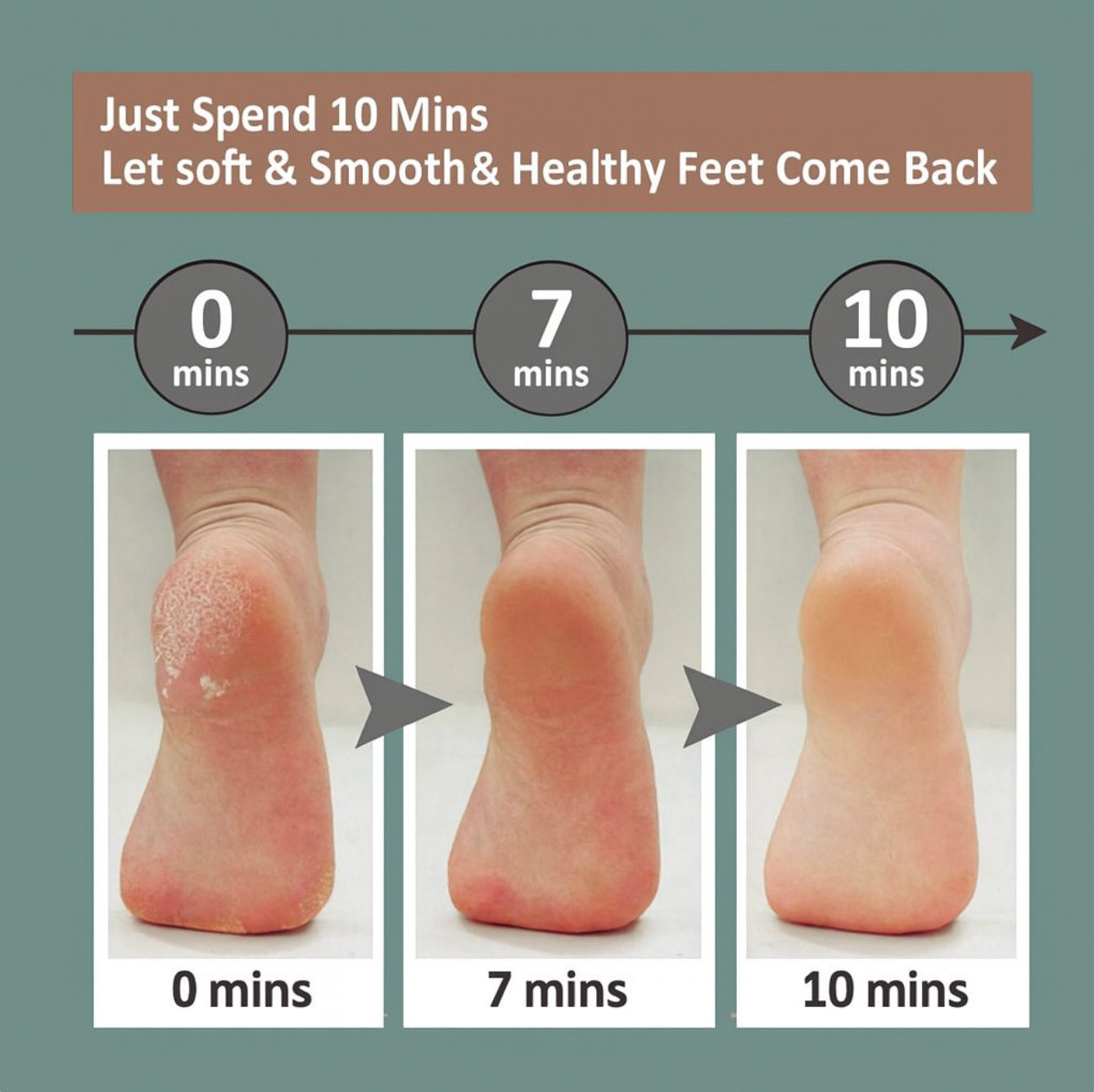 Electric Foot File Pro