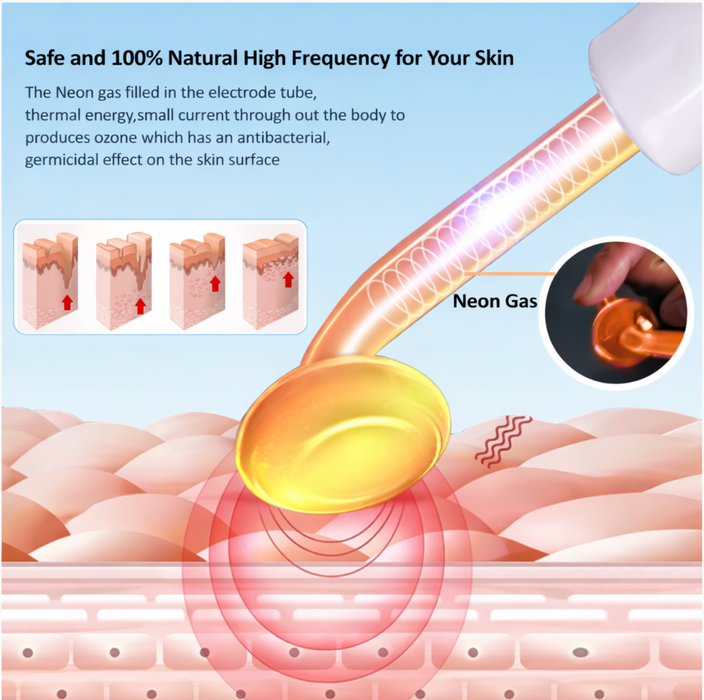 Velivia™ ClearSonic